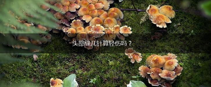 头部缝几针算轻伤吗？,第1张